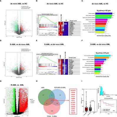 Lin28A/CENPE Promoting the Proliferation and Chemoresistance of Acute Myeloid Leukemia